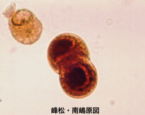 CMV infected cells