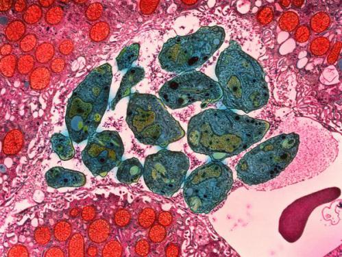 Toxoplasma gondii