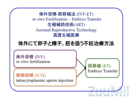 IVFという名称