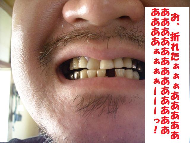 吸気口
