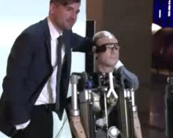 バイオニック人間