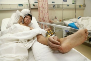Man-has-severed-hand-attached-to-leg-to-keep-it-alive-2933370.jpg