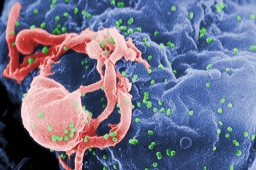 HIV-1.jpg