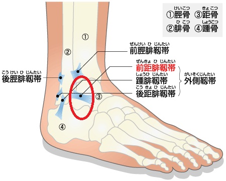 腓骨筋腱炎なんやて 走る はちみつ屋